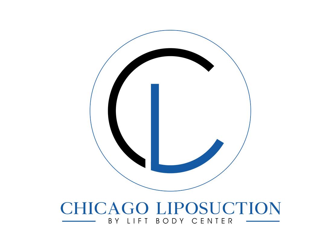 Chicago Liposuction by Lift Body Center